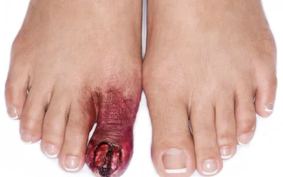 Prótesis SFX para cine, tele y teatro